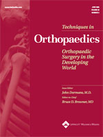 The Neglected Clubfoot